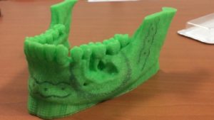 Reconstruction 3D de la mandibule d’une patiente © CIRIMAT